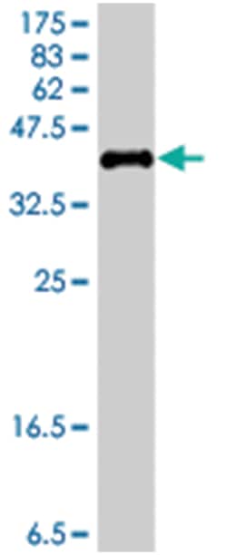 KDM5B, Mouse, Polyclonal Antibody, Abnova 50 &mu;L | Buy Online | Abnova Corporation | Fisher Scientific