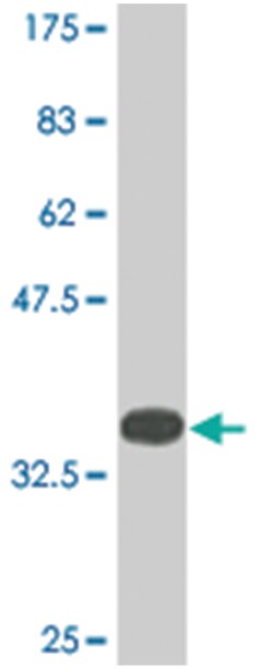 KDM5B, Mouse, Clone: 1G10, Abnova 200&mu;L; Unlabeled:Antibodies, Monoclonal
