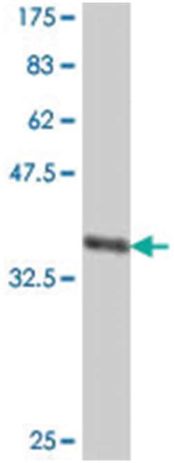 AHCYL1, Mouse, Polyclonal Antibody, Abnova 50 &mu;L | Buy Online | Abnova | Fisher Scientific