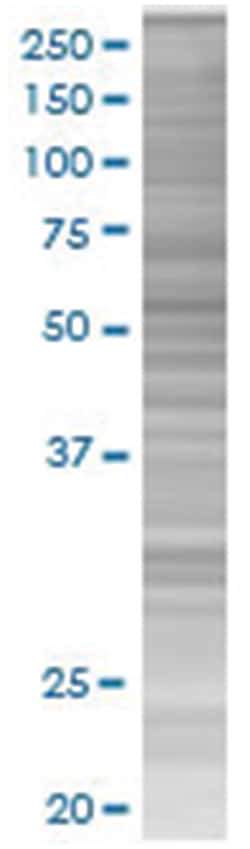 Abnova ZNF482 293T Cell Overexpression Lysate (Denatured), Abnova