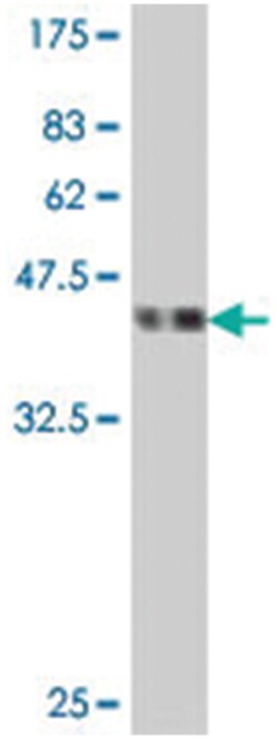 POP4, Mouse, Polyclonal Antibody, Abnova 50&mu;L; Unlabeled:Antibodies,