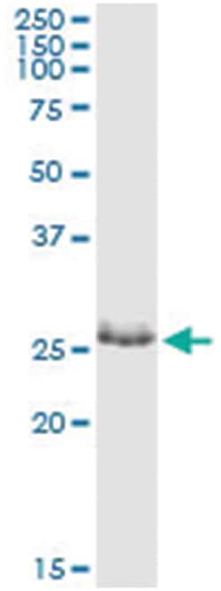 anti-ZNF266, Human, IP-WB Antibody Pair, Abnova&trade;
