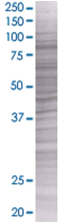 ZNF274 293T Cell Overexpression Lysate (Denatured), Abnova 100 &mu;l | Buy Online | Abnova | Fisher Scientific