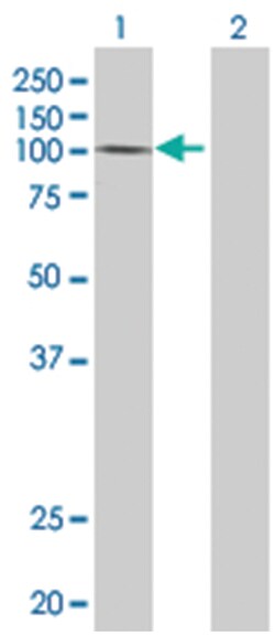 ZNF274 293T Cell Overexpression Lysate (Denatured), Abnova 100 &mu;l | Buy Online | Abnova | Fisher Scientific