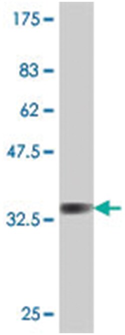 VAMP5, Mouse, Polyclonal Antibody, Abnova 50&mu;L; Unlabeled:Antibodies,