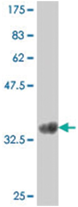 CYSLTR1, Mouse, Polyclonal Antibody, Abnova 50&mu;L; Unlabeled:Antibodies,