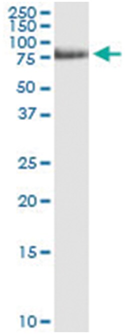 anti-WASF3, Human, IP-WB Antibody Pair, Abnova&trade;