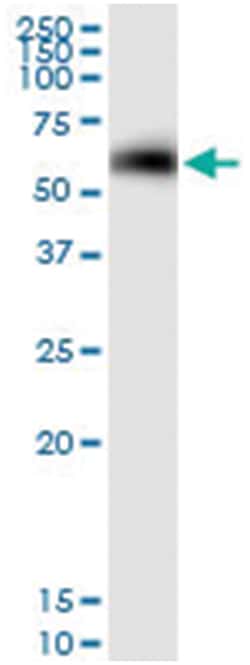 anti-NOXA1, Human, IP-WB Antibody Pair, Abnova&trade;