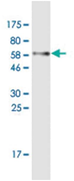 FRS2, Mouse, Clone: S1, Abnova 200&mu;L; Unlabeled:Antibodies, Monoclonal