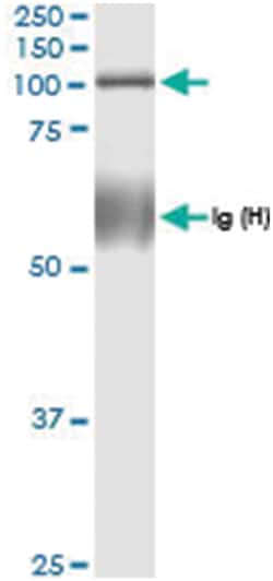 anti-TUBGCP2, Human, IP-WB Antibody Pair, Abnova 1 Set:Antibodies, Monoclonal/Polyclonal