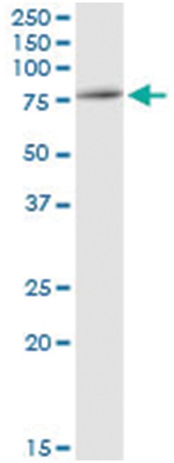anti-RUVBL2, Human, IP-WB Antibody Pair, Abnova&trade;
