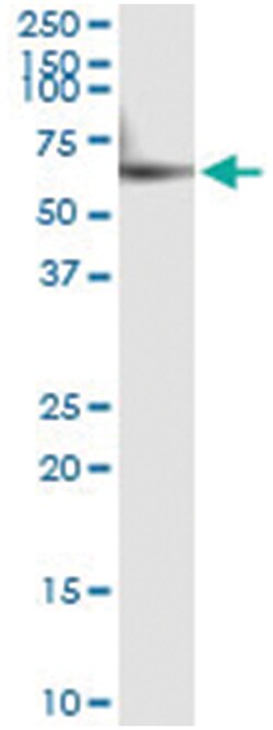 anti-CYP46A1, Human, IP-WB Antibody Pair, Abnova™
