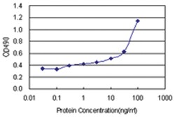 anti-FGL2 Matched Antibody Pair, Abnova&trade;