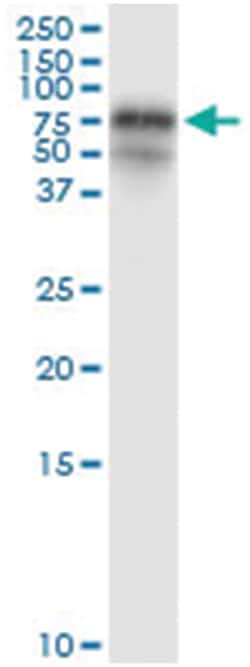 FGL2, Human, IP-WB Antibody Pair (PW2), Abnova 1 Set:Antibodies, Monoclonal/Polyclonal