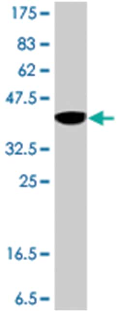 PPARGC1A, Mouse, Polyclonal Antibody, Abnova 50&mu;L; Unlabeled:Antibodies,
