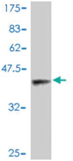 MALT1, Mouse, Polyclonal Antibody, Abnova 50&mu;L; Unlabeled:Antibodies,