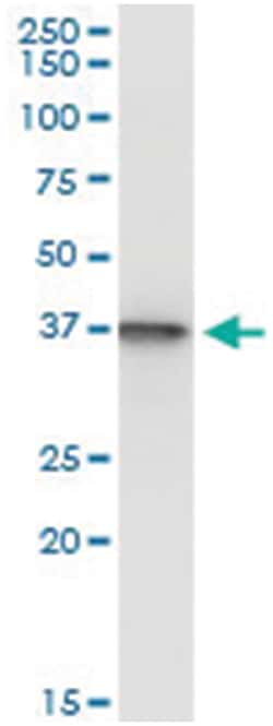 anti-SUGT1, Human, IP-WB Antibody Pair, Abnova 1 Set:Antibodies, Monoclonal/Polyclonal