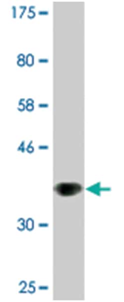 EDAR, Mouse, Clone: 3A7, Abnova 200&mu;L; Unlabeled:Antibodies, Monoclonal