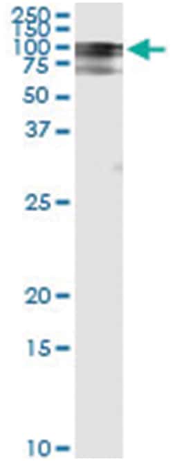 anti-RALBP1, Human, IP-WB Antibody Pair, Abnova&trade;