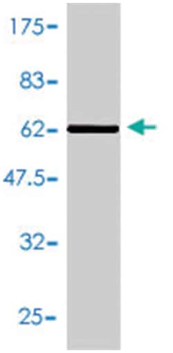 PRDX3, Mouse, Polyclonal Antibody, Abnova 50 &mu;L | Buy Online | Abnova Corporation | Fisher Scientific