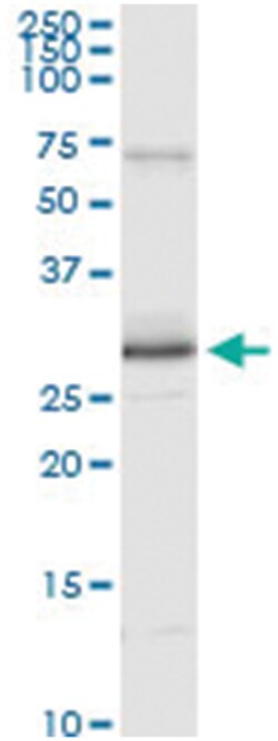 anti-PRDX3, Human, IP-WB Antibody Pair, Abnova 1 Set:Antibodies, Monoclonal/Polyclonal
