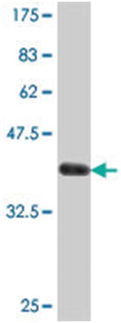 PRSS21, Mouse, Polyclonal Antibody, Abnova 50 &mu;L | Buy Online | Abnova Corporation | Fisher Scientific