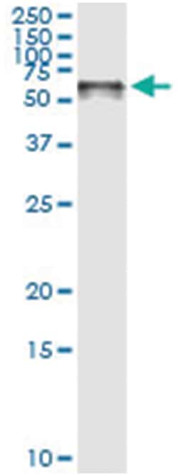 anti-STIP1, Human, IP-WB Antibody Pair, Abnova 1 Set | Buy Online | Abnova Corporation | Fisher Scientific