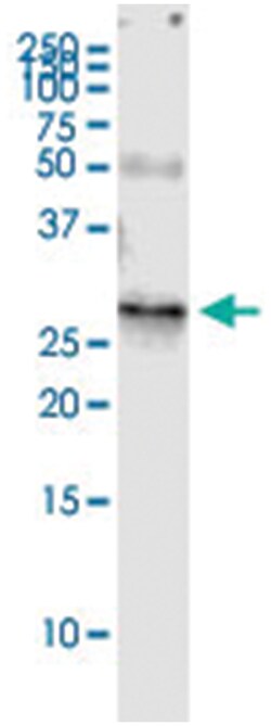 RAB32, Human, IP-WB Antibody Pair (PW3), Abnova&trade;