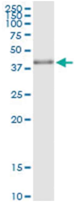 anti-MAPRE2, Human, IP-WB Antibody Pair, Abnova&trade;