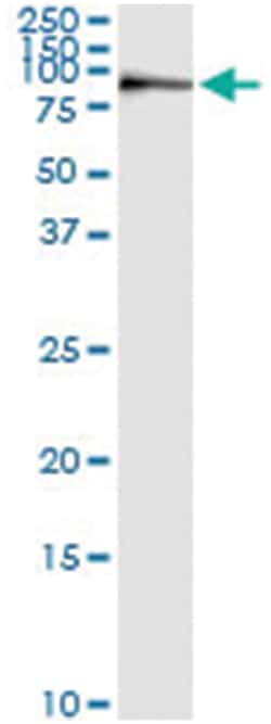 anti-KIF2C, Human, IP-WB Antibody Pair, Abnova&trade;