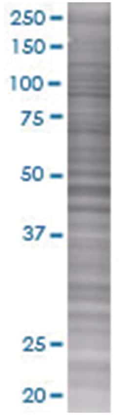 IL24 293T Cell Overexpression Lysate (Denatured), Abnova