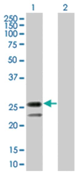 IL24 293T Cell Overexpression Lysate (Denatured), Abnova 100 &mu;L | Buy Online | Abnova | Fisher Scientific