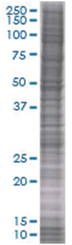 RBPMS 293T Cell Overexpression Lysate (Denatured), Abnova 100 &mu;L | Buy Online | Abnova | Fisher Scientific