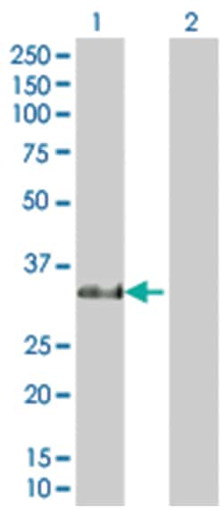 RBPMS 293T Cell Overexpression Lysate (Denatured), Abnova 100 &mu;L | Buy Online | Abnova | Fisher Scientific