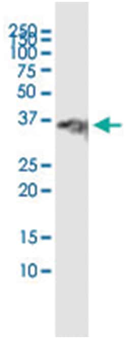 anti-PIM2, Human, IP-WB Antibody Pair, Abnova 1 Set:Antibodies, Monoclonal/Polyclonal