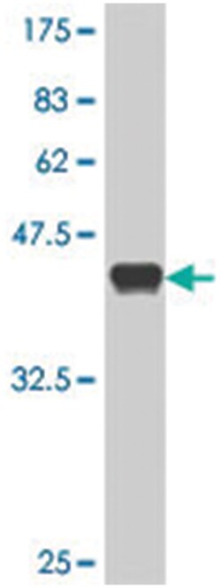 POLS, Mouse, Polyclonal Antibody, Abnova 50 &mu;L | Buy Online | Abnova | Fisher Scientific