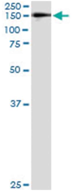 anti-WWP1, Human, IP-WB Antibody Pair, Abnova&trade;