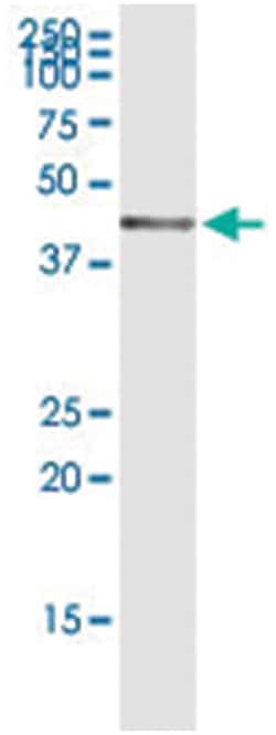 anti-LECT1, Human, IP-WB Antibody Pair, Abnova&trade;