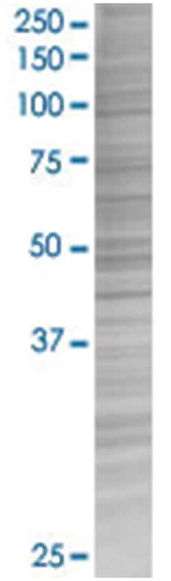 DUSP14 293T Cell Overexpression Lysate (Denatured), Abnova 100 &mu;L | Buy Online | Abnova | Fisher Scientific