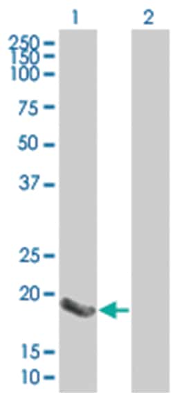 DUSP14 293T Cell Overexpression Lysate (Denatured), Abnova 100 &mu;L | Buy Online | Abnova | Fisher Scientific