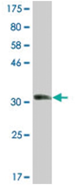 STMN2, Mouse, Clone: 2B2, Abnova 200 &mu;L | Buy Online | Abnova Corporation | Fisher Scientific