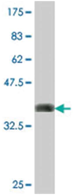keratocan, Mouse, Polyclonal Antibody, Abnova 50 &mu;L | Buy Online | Abnova Corporation | Fisher Scientific