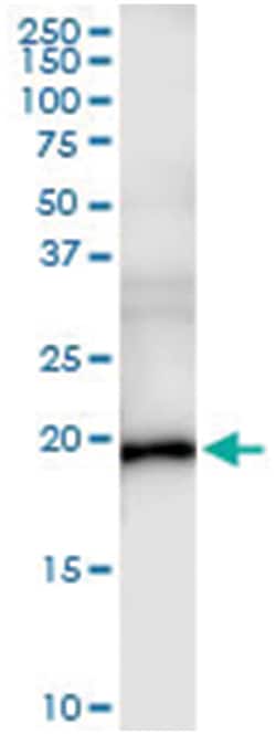 anti-ESM1, Human, IP-WB Antibody Pair, Abnova 1 Set:Antibodies, Monoclonal/Polyclonal