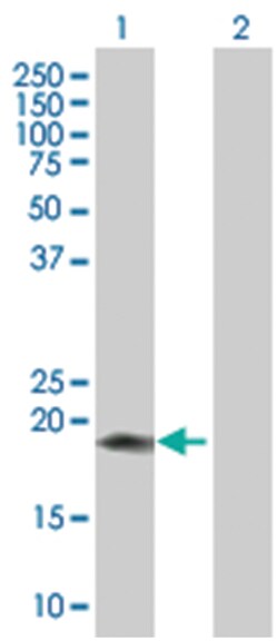 CD160 293T Cell Overexpression Lysate (Denatured), Abnova 100 &mu;L | Buy Online | Abnova | Fisher Scientific