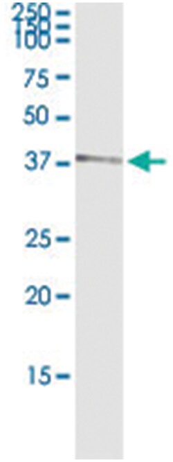 anti-ZWINT, Human, IP-WB Antibody Pair, Abnova&trade;