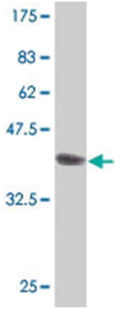 IL1RAPL1, Mouse, Polyclonal Antibody, Abnova 50 &mu;L | Buy Online | Abnova | Fisher Scientific