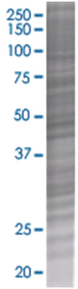 HRASLS3 293T Cell Overexpression Lysate (Denatured), Abnova