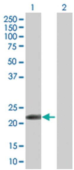 HRASLS3 293T Cell Overexpression Lysate (Denatured), Abnova