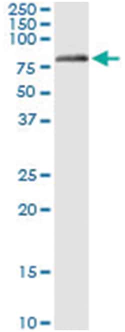 GLMN, Human, IP-WB Antibody Pair (PW2), Abnova 1 Set:Antibodies, Monoclonal/Polyclonal