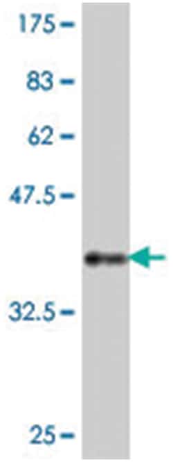 PTP4A3, Mouse, Polyclonal Antibody, Abnova 50&mu;L; Unlabeled:Antibodies,